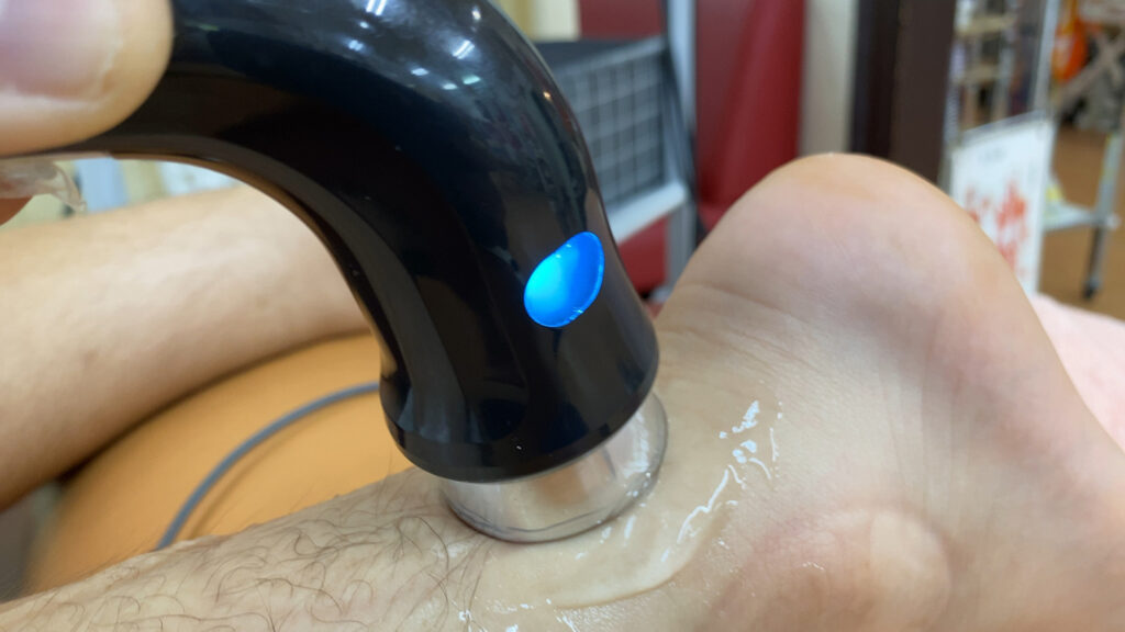 大田区アキレス腱炎治療