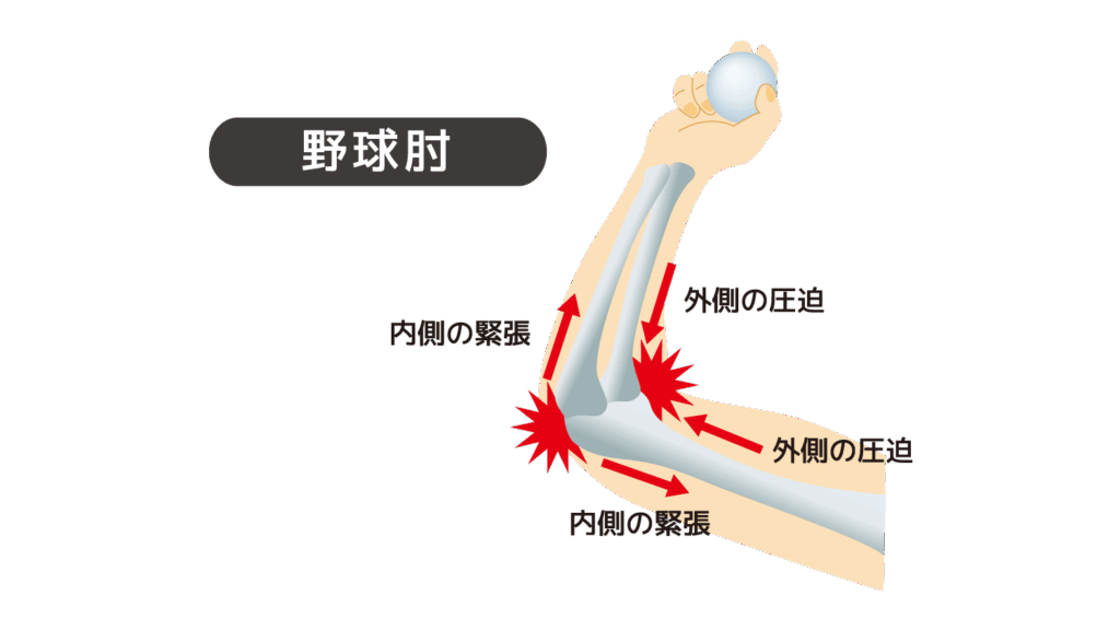 大田kう野球肘外来