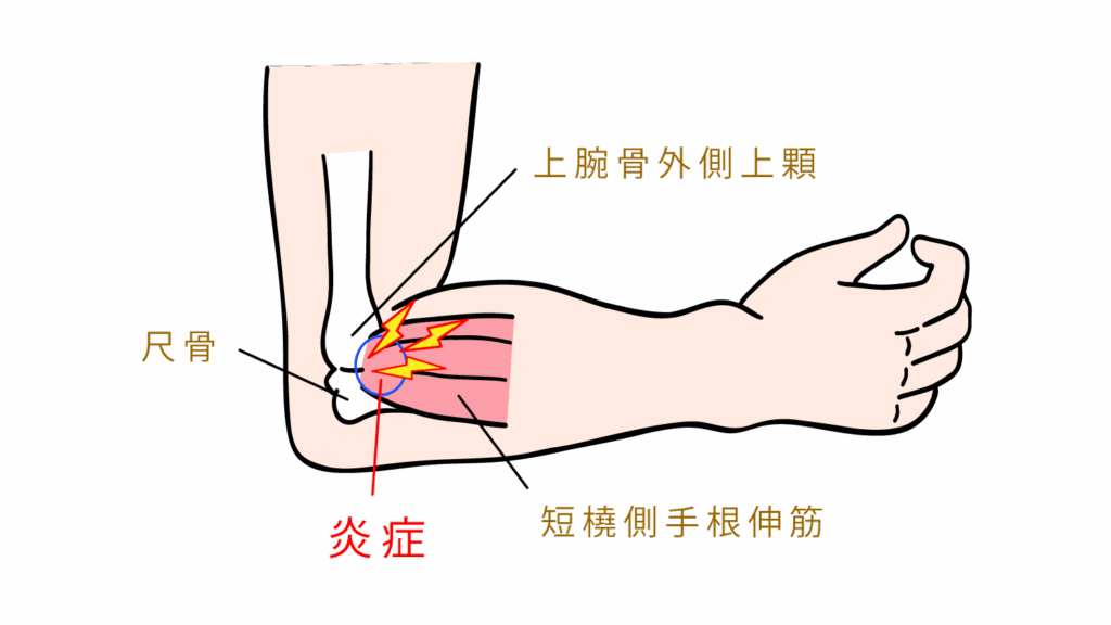 大田区野球肘外来