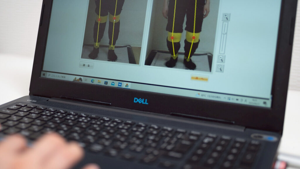 大田区腰痛整体