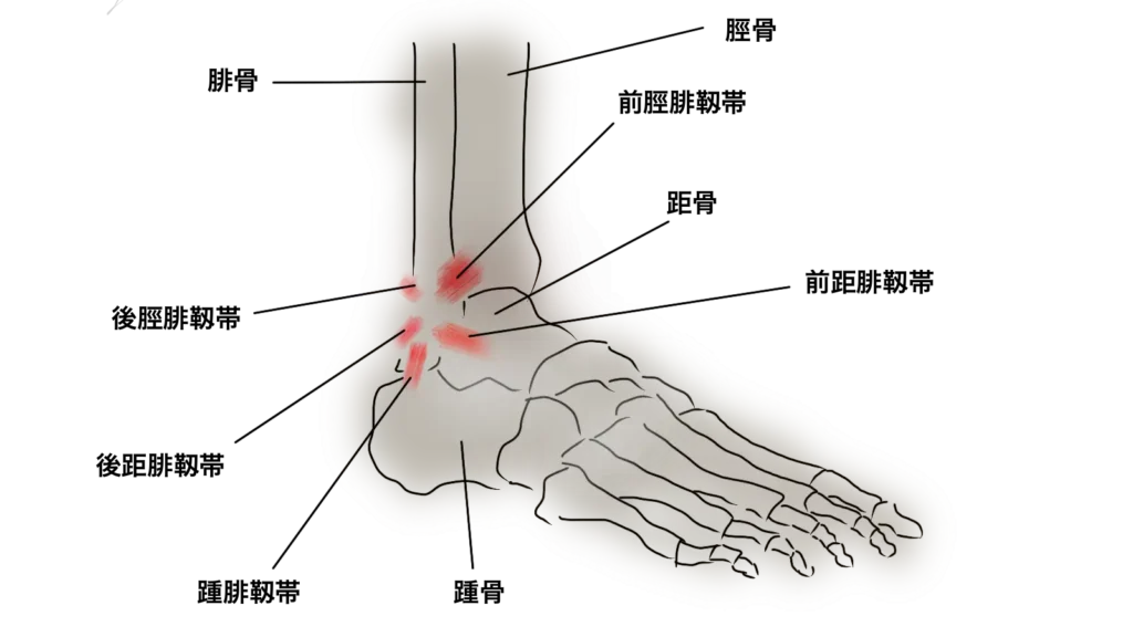 大田区足首ねんざ治療