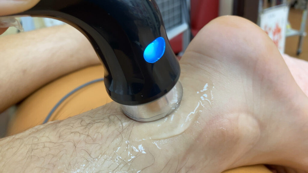 大田区足首捻挫治療