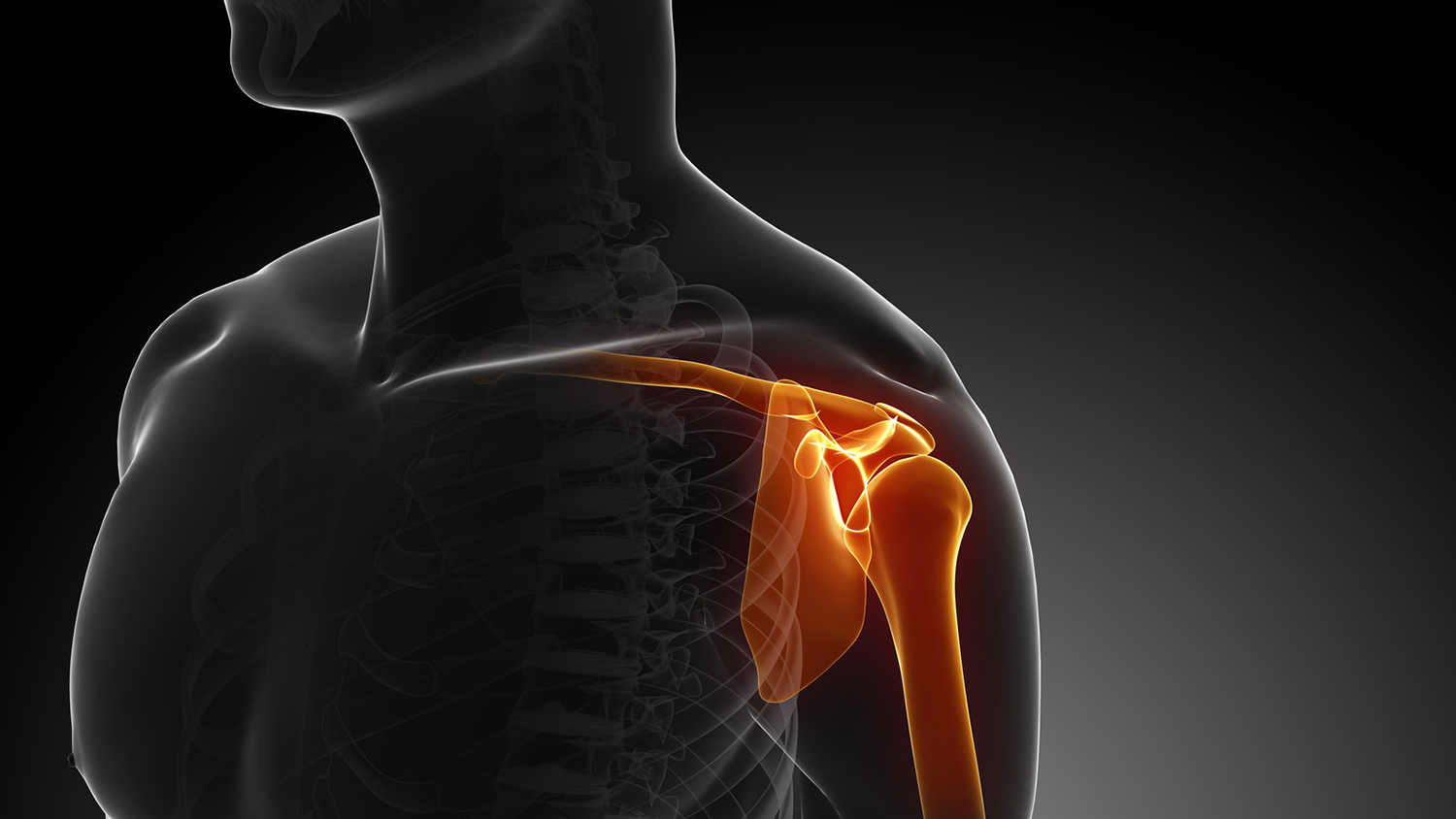 大田区腱板炎治療