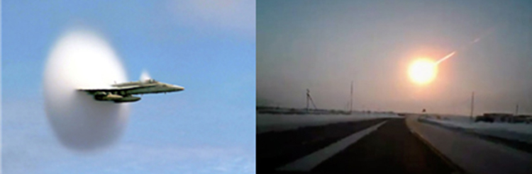 坐骨神経痛の衝撃波治療