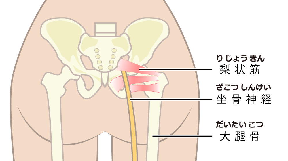 大田区坐骨神経痛の治療